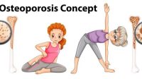 mencegah osteoporosis