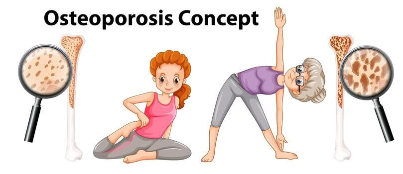 mencegah osteoporosis
